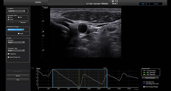 arterial-analysis1 arterial-analysis1