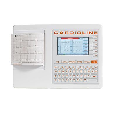 ecg