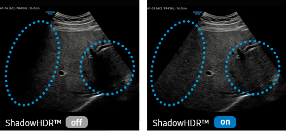 01shadowhdr-img-lg