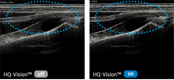 02hqvision-img-lg