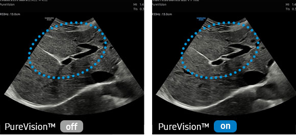 06purevision-img-lg