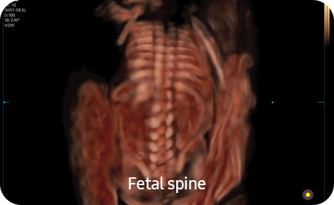 img_crystalvue img_crystalvue