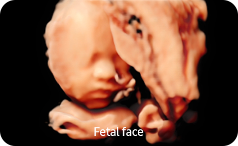 img_realisticvue img_realisticvue